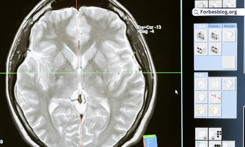 Hair Transplant Effects on Brain