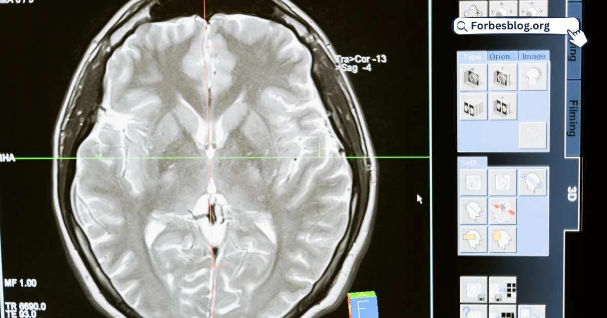 Hair Transplant Effects on Brain