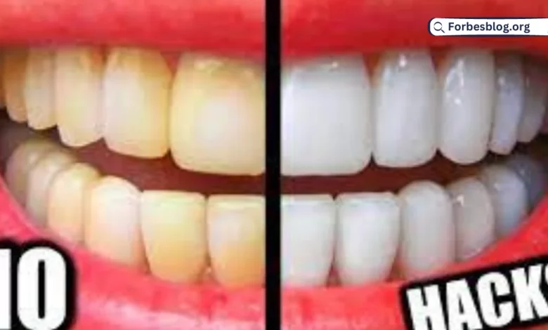 Super Effective Ways for Teeth Whitening