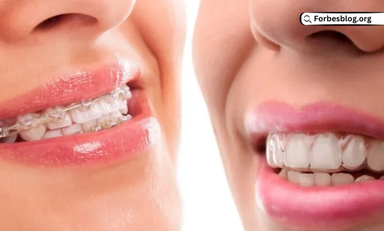 Invisalign