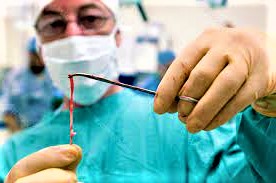 Vein Surgery