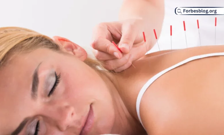 Does Acupuncture Treat