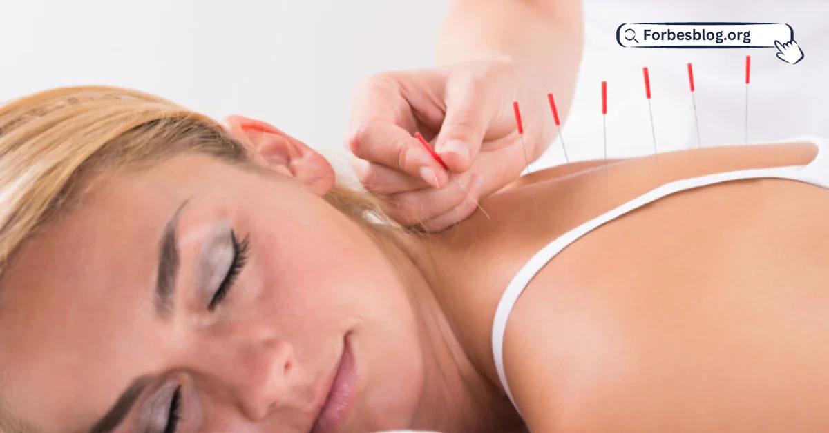 Does Acupuncture Treat