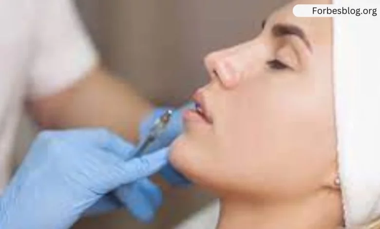 Dermal Fillers: