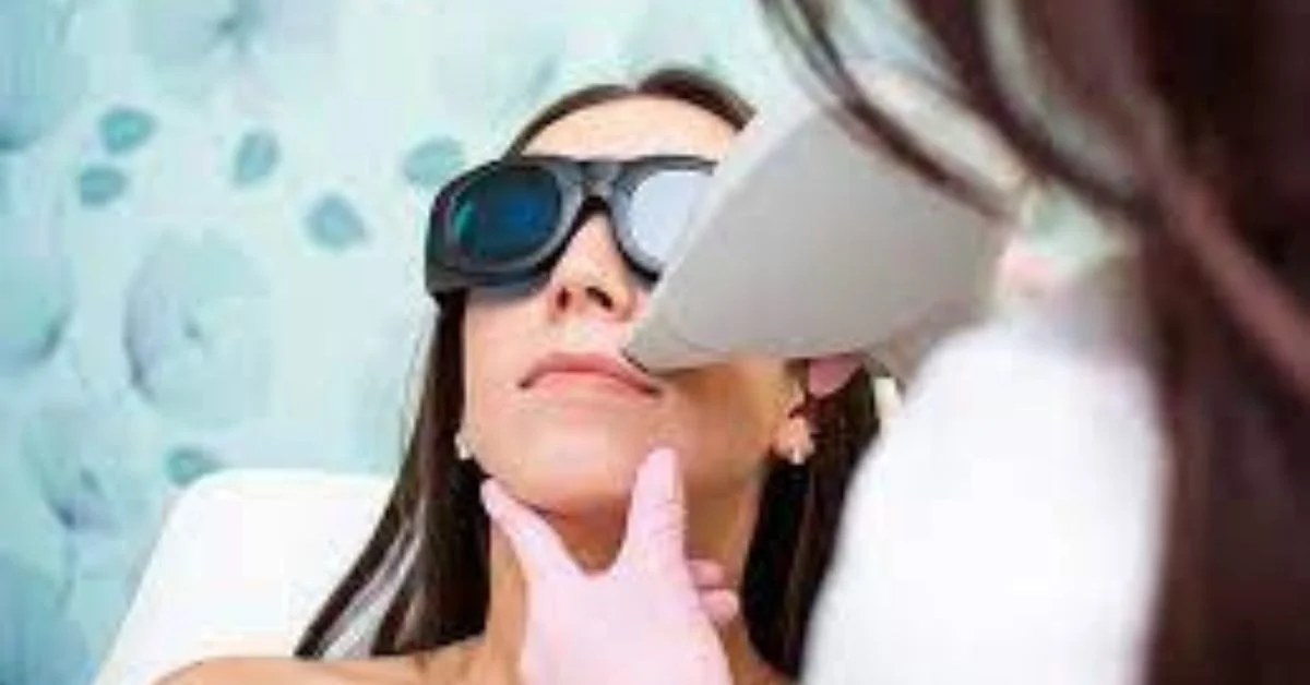 Laser hair removal