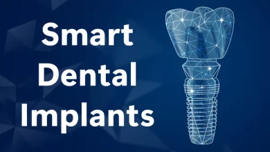 Smart Dental Implants