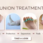 How to Keep Running While Managing Bunions